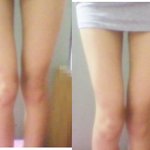 <b>판녀</b>의 다리고민 사진