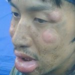 얼굴때문에 사는게 참 힘드네요..