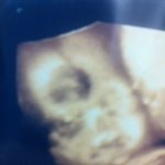 <b>뱃속</b>에 있는딸을 소개합니다!!!!!