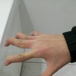 (<b>사진</b>有) ☆★☆(혐오주의) 제친구<b>손</b>이 이상해요☆★☆