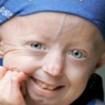 ■■ 100살의 몸을 가진 14세 소녀 ■■