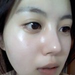 얼굴은 이쁜데 <b>여드름</b> 있는 여자 싫어하나요?