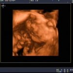 머리숱따위 많아 질거라면서...딸래미 성장일기~!!