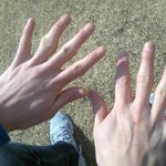 사진有) 내손가락보고 놀라지좀마세요 (※혐오주의)