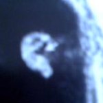 <+얼집사진 추가> (사진 많이 有) ♡사고뭉치 우리 훈이♡