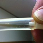 너무 화가납니다!!! 돌 지난 아가 링거수액 이물질 발견!!