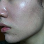제 피부 많이 더러운<b>가요</b>....