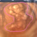 우리에게 찾아온 <b>천사</b>^^♥