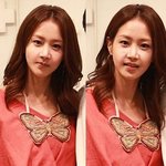 ★<b>양악</b>수술 아찔한 순간들 공개★