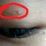 앞머리짜르다<b>눈두덩</b>이살짤랏어요