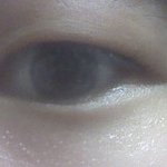 [사진有]<b>저</b> <b>눈</b> 좀 봐주세요ㅠㅠㅠ