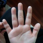 #####사진有####  집에서 맨손으로 탈색했어요.......^0^