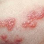 날씨가 좋아도 환절기 <b>질병</b>은 예방해야