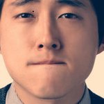 점뺄려고하는데 점쫌봐주세요!! (ㅅㅏ진有)
