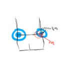 오른쪽골반과 그쪽<b>부위</b>가 아파요