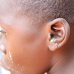 귀속을 가득 채운 고름덩어리...