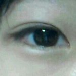 <b>쌍수</b>잘된건가요 ㅠ?사진有