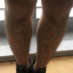 언니들 ㅠㅠㅠㅠ다리가이상해서.....여름때 <b>어떠</b>케용 ㅠㅠㅠ