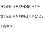 성형에 대해 궁금한 점