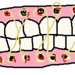 말많은 양악수술.. 경험담 (추가)