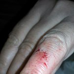 이웃집 미친여자때문에 못살겠어요