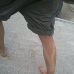 (사진有)★추가★<b>다리</b>에 y자글자생겼어욬ㅋㅋㅋㅋㅋㅋㅋ