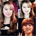 ★★원더걸스 <b>혜림</b> 성형의혹 최근..