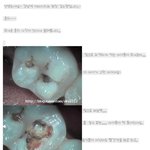 <b>양치</b>를 잘해야하는이유는요