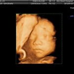 이모야가 튼튼이에게 주는 선물♥