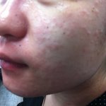 <b>gs25</b> 새로나온 김밥먹고 이렇게 됐습니다