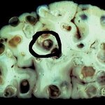 ★★★★★★돼지고기 좋아하는사람 필독...★★★★★★★★(사진有느님♥)