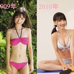 ★[엄빠] 이거 수술? 안수술?  판단부탁