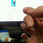 손가락 꼬매보신분들 이것좀 봐주세여
