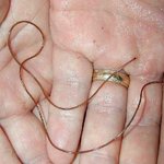 뇌에서 발견된 <b>벌레</b>