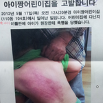 <b>랭킹</b>뉴스에 어린이집 아동폭행사진