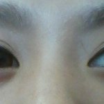 사진 有 )정말.. 어떻게 해야되죠? 이놈의 붓기 누가좀도와주세요...