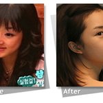 연예계 성형수술로 대박난 스타 <b>top</b> 8