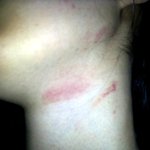 ★ 정신질환 폭행 사건, 뉴스 <b>보도</b> 영상, 사진 有 ★