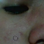 <b>혐오주</b>의)이런피부ㅠㅠ어떻게관리하나요?