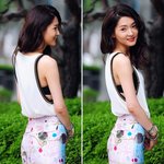 쌍수 <b>전이</b> 훨씬 나아 보이는 차수연..ㅠㅠ
