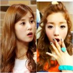 "박초롱vs윤보미"