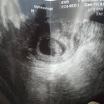 아들의 50일동안 세상적응기(스압쩔어요)