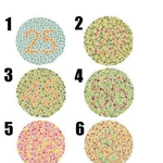 색맹테스트 (사진유)