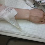 세브란스에서 <b>바늘</b> 꽂는 방법