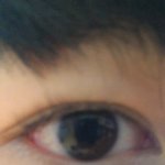 남자인데 <b>쌍꺼풀</b> 어떻게 없애나요 ..