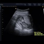 고슴도치 엄마'-' 울 왕자님 봐주세요^3^