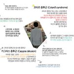 코타르 증후군(걷는 <b>시체</b> 증후군) 을 아시나요?