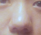 <b>복코</b> 심함??