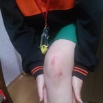 ★★★★★비오는날 전교생앞에서 친구 넘어지게해서 친구유명인됨 (베톡되면...