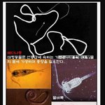 (진짜 혐오 주의)살갛을 뚫고 나오는 <b>메디</b>나충